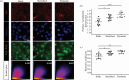 Impact of mechanical states on confluent cells (2.5x104 cell seeding density for two-day culture per well)