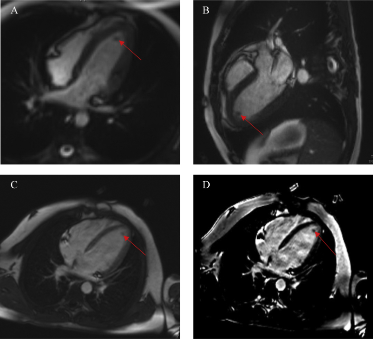 Figure 3