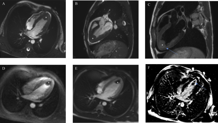 Figure 2