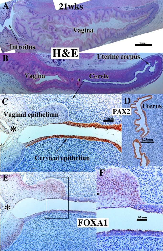 Figure 14.