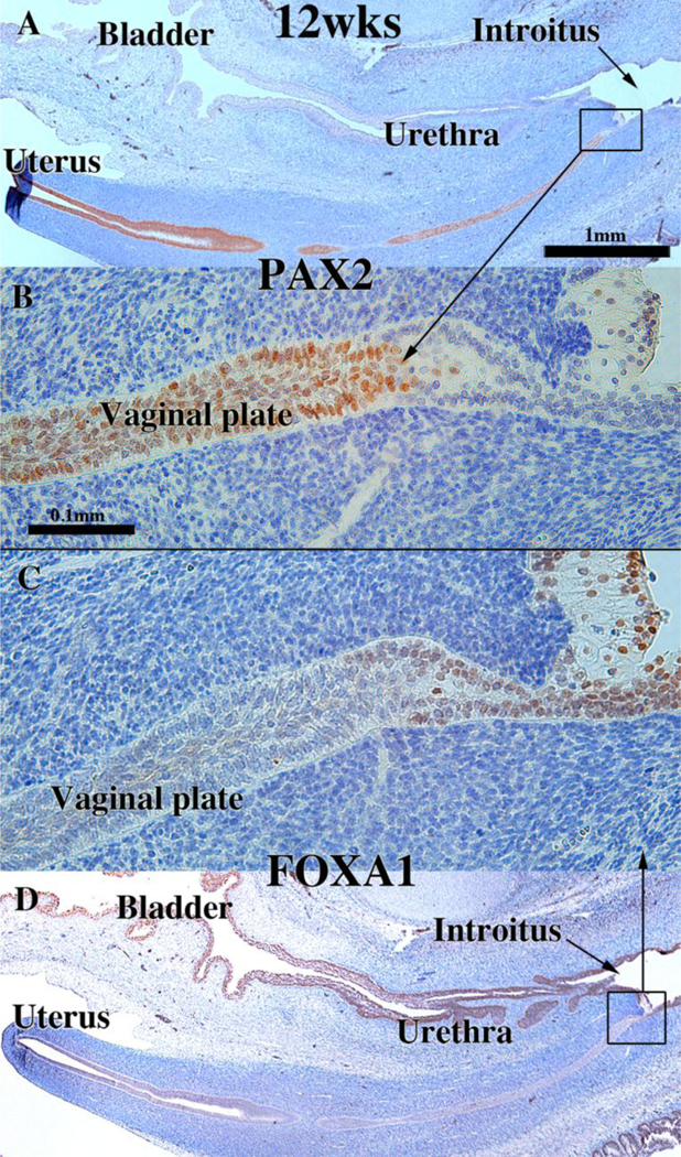 Figure 11.