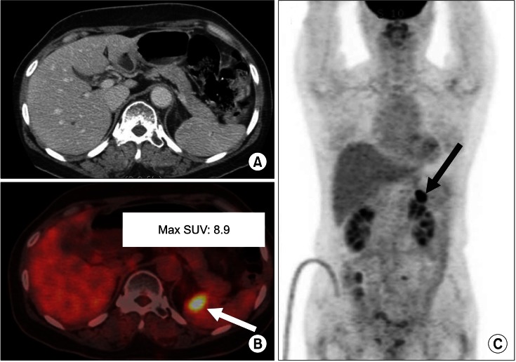 FIG. 3