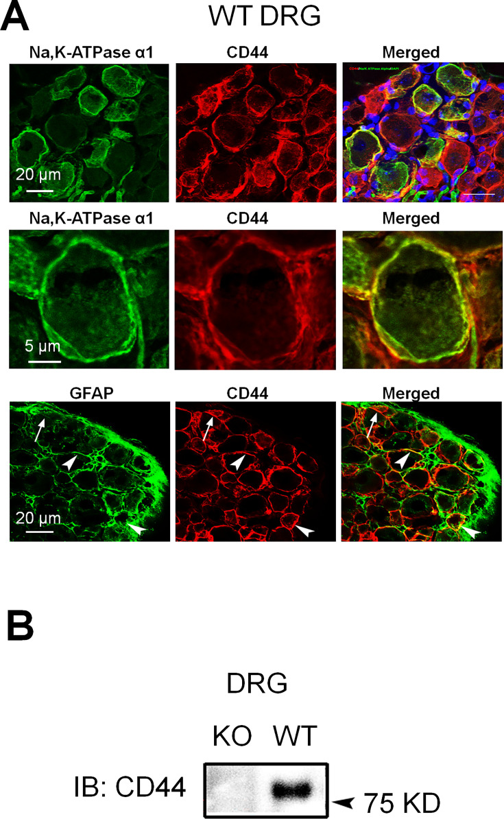 Figure 4—figure supplement 1.