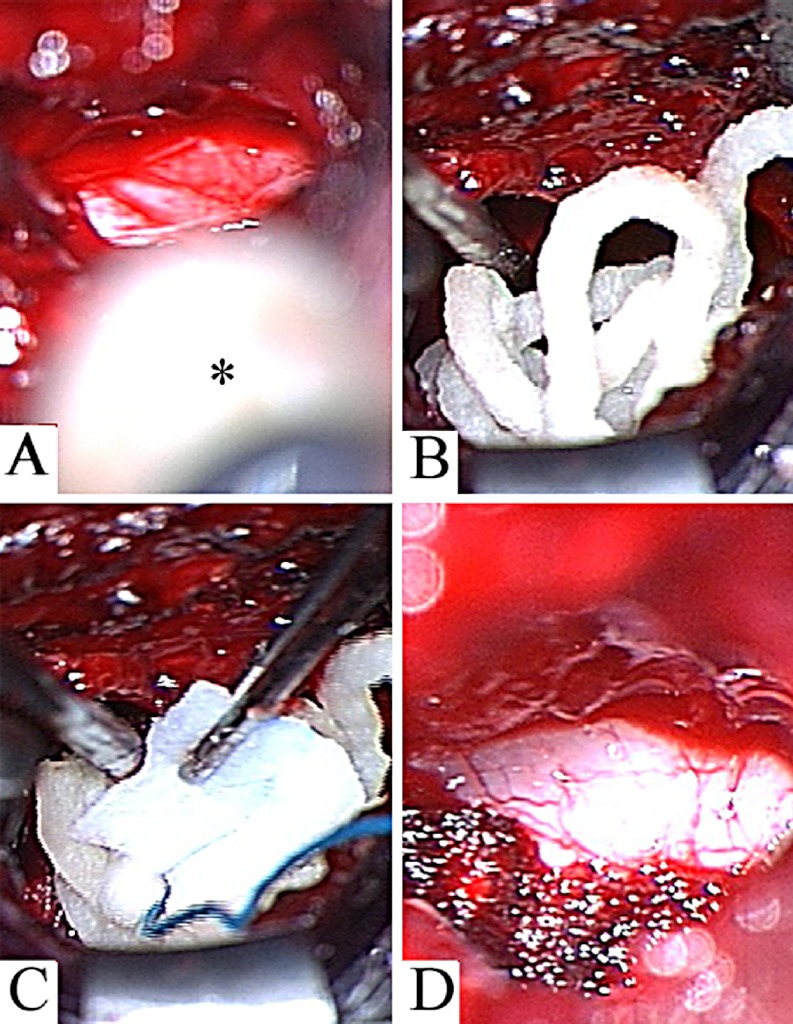 Fig. 5 A