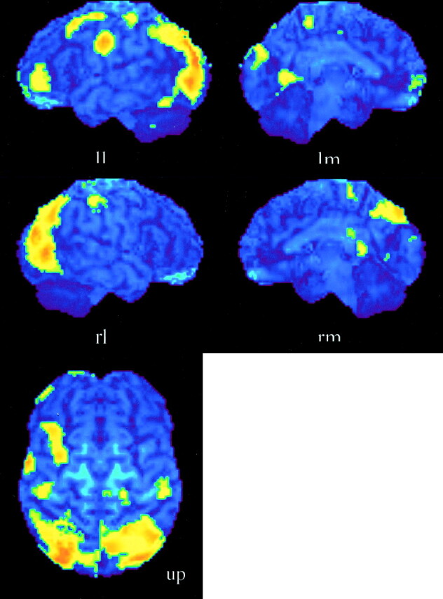 Fig 2.