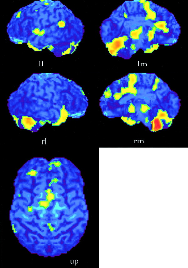 Fig 1.