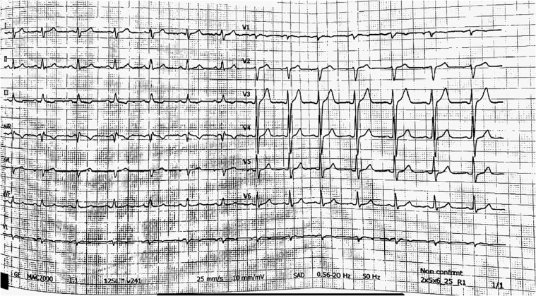 Fig 1 -