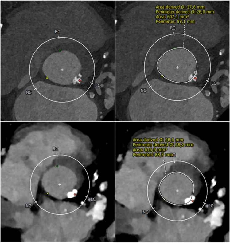 Fig. 2