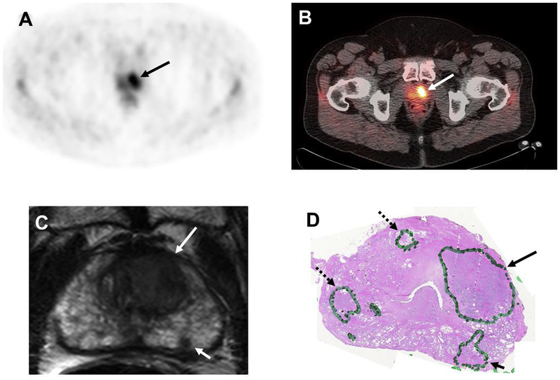 Fig 3.