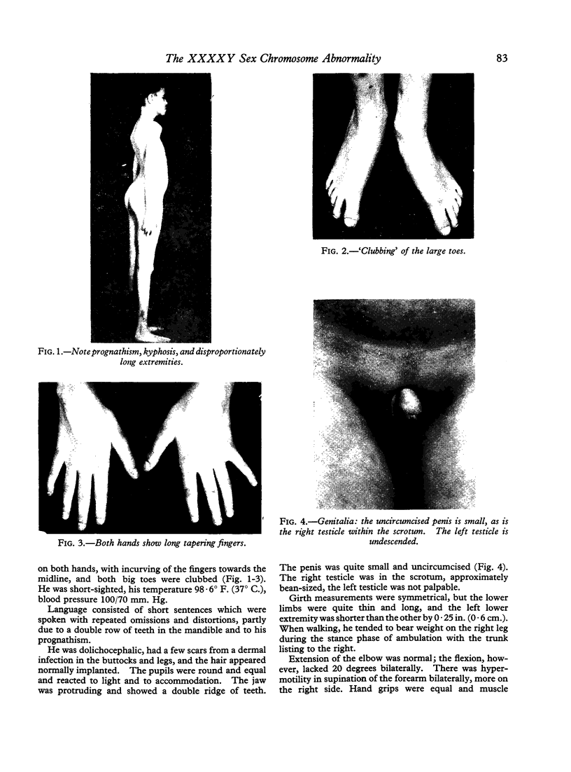 83