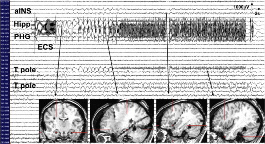 Fig. 3