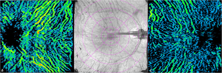 Fig. 2