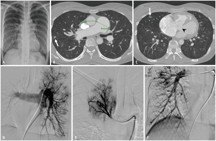 Fig. 12