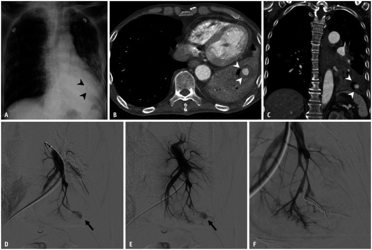 Fig. 11