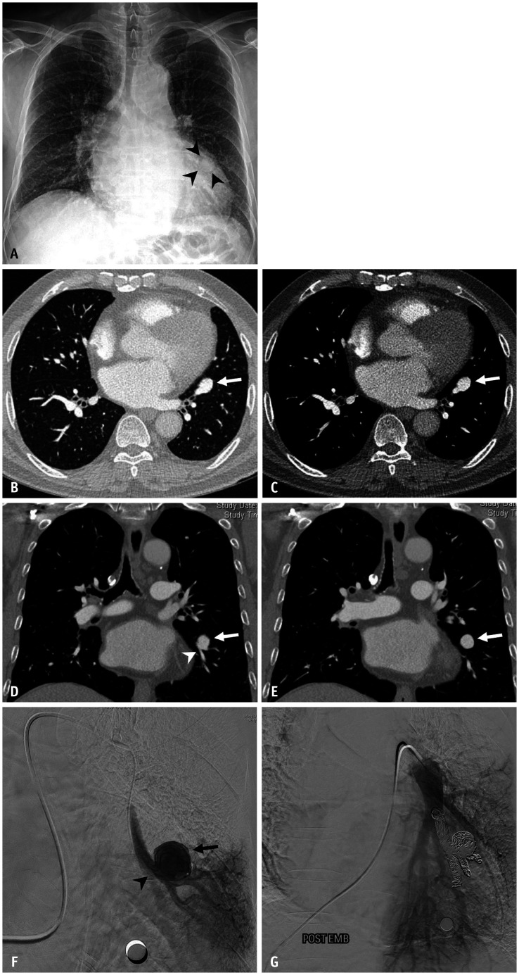 Fig. 10