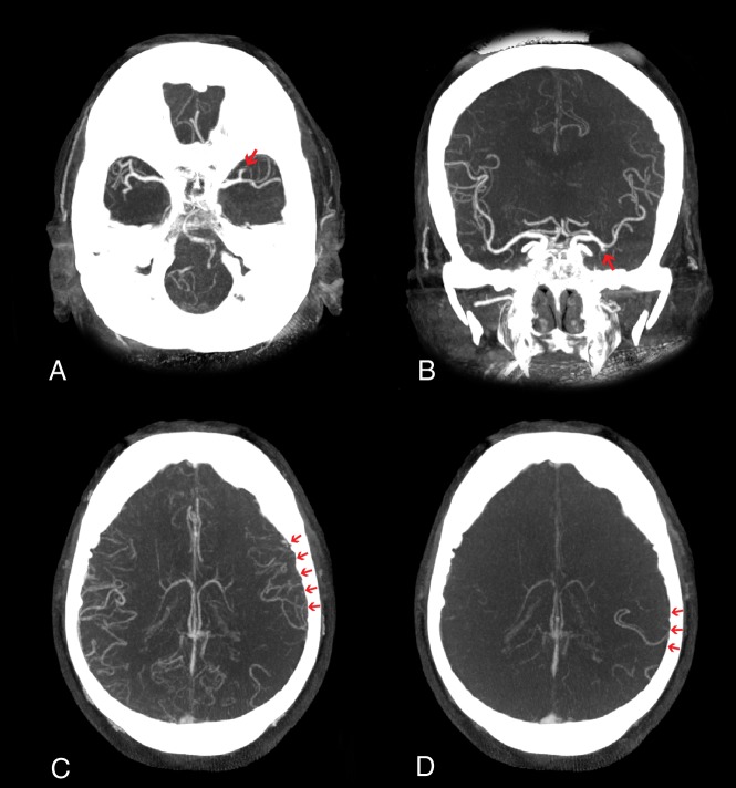 Fig 1.