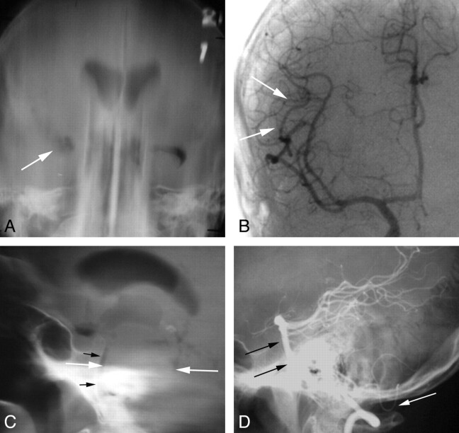 Fig 2.