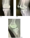 Figure1