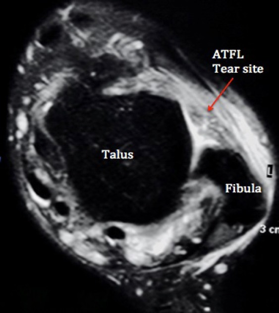 Figure 1a