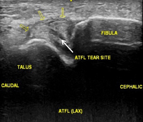 Figure 1b