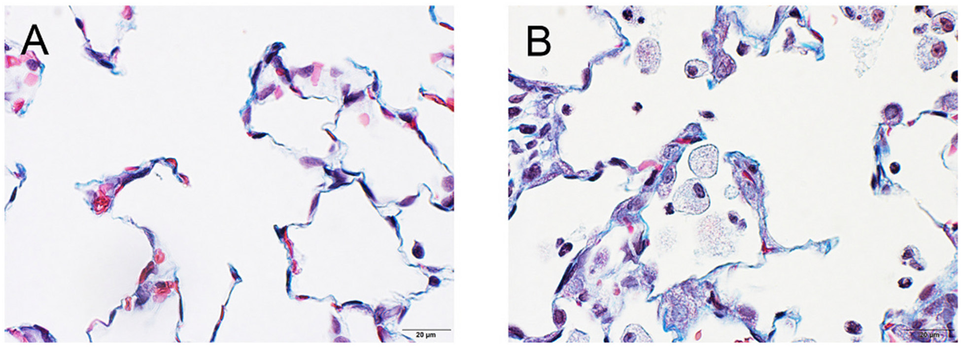 Fig. 12.