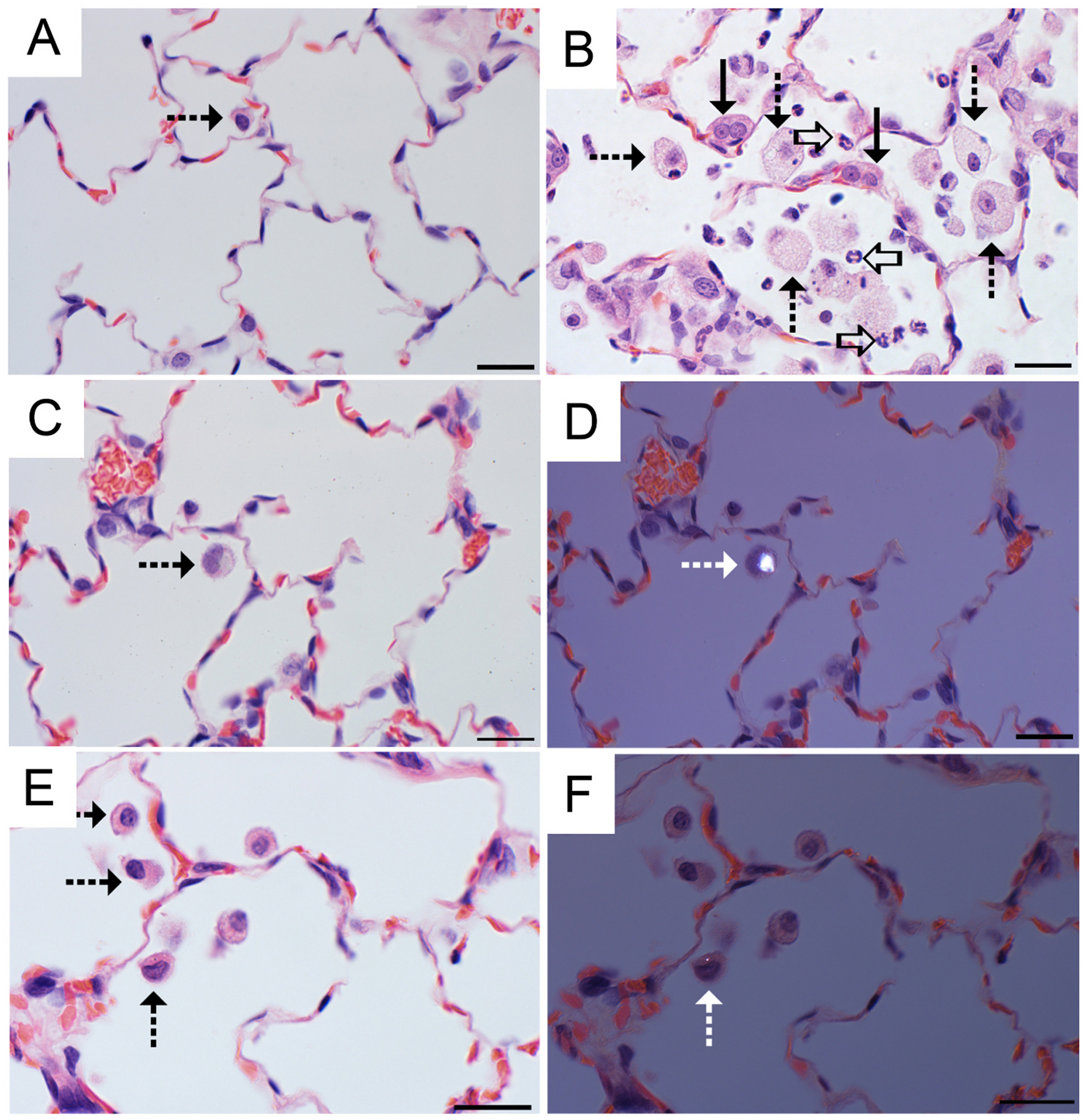 Fig. 11.