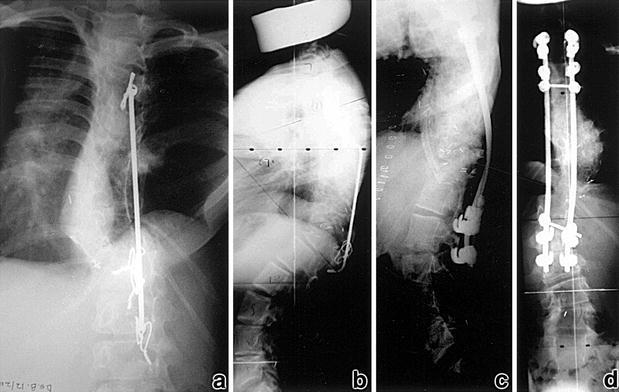 Fig. 4. a,b