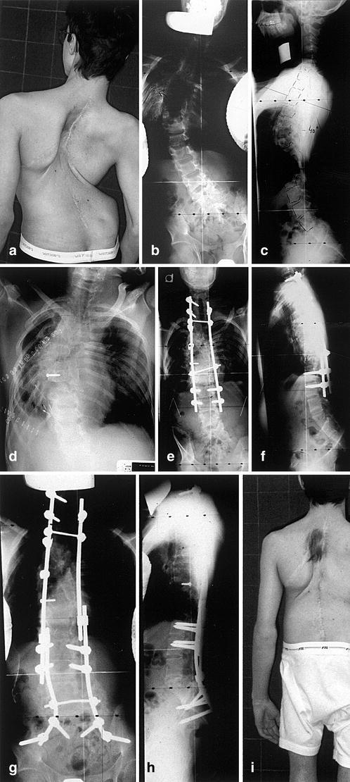 Fig. 6. a–c