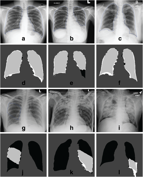 Figure 14