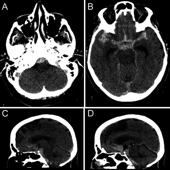 FIG. 1