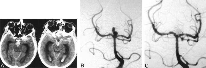 Fig 1.