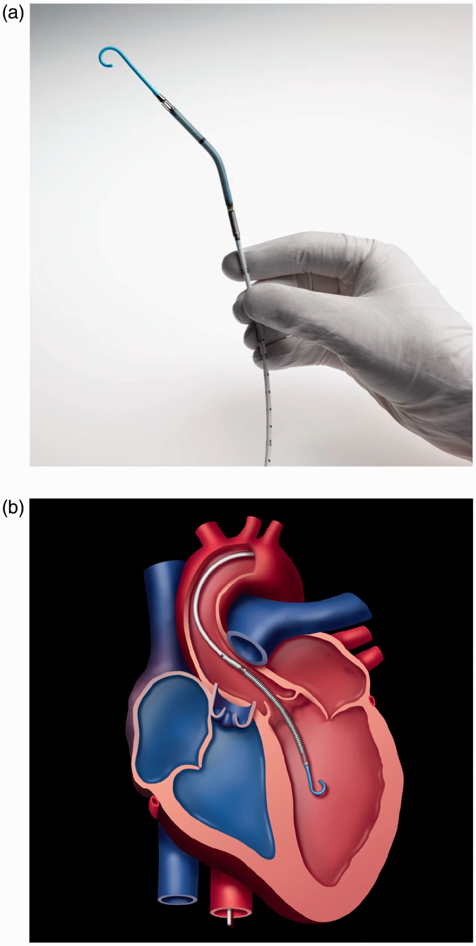 Figure 10.