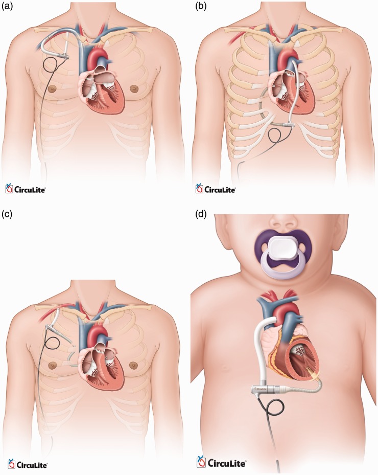 Figure 21.