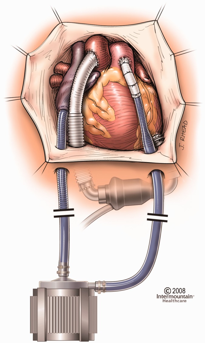 Figure 16.