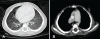 Figure 2)