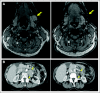 Fig 3.