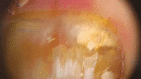 Fig. 11