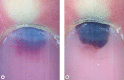 Fig. 19