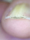 Fig. 26