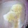 Fig. 18