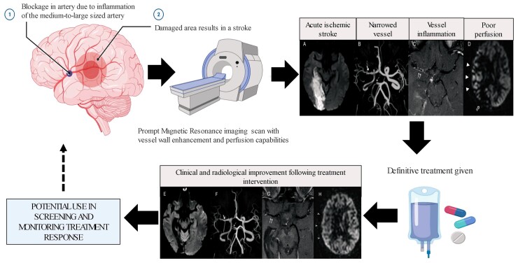 Graphical abstract