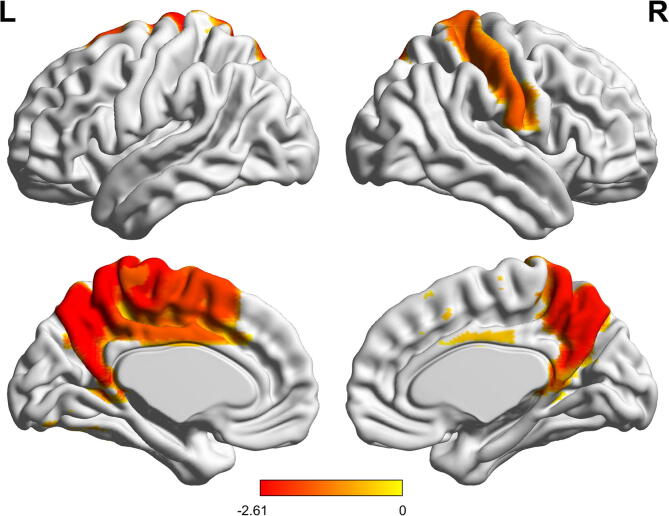 Fig. 4