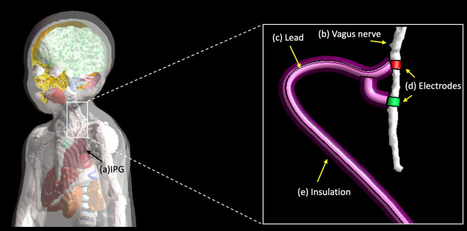 Fig 12