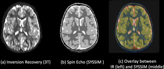 Fig 13