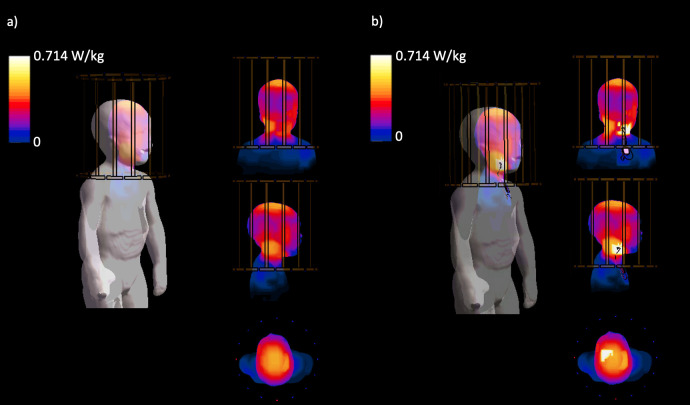 Fig 14