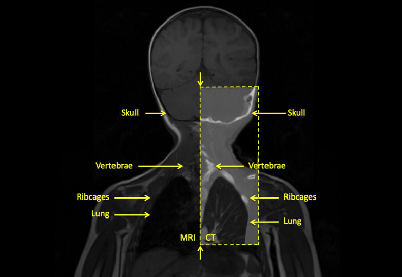 Fig 3