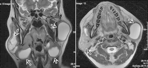 Fig. 5