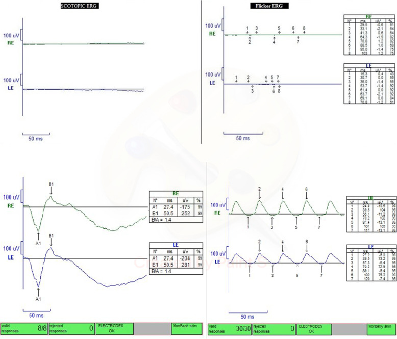 Fig. 2