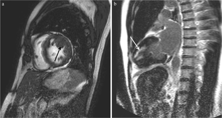 Fig. 15