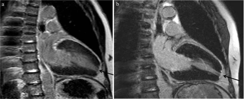 Fig. 17